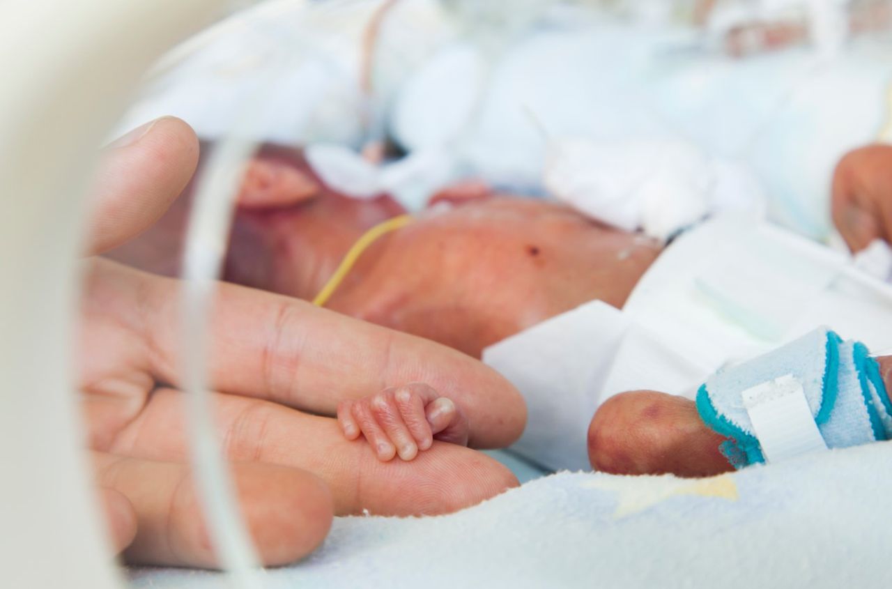 Holoprosencefalia - czym jest, etiologia, postacie, objawy, rokowania