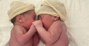 Przypadek jeden na 80 tys. urodzeń. Niezwykłe zdjęcia z porodu bliźniąt