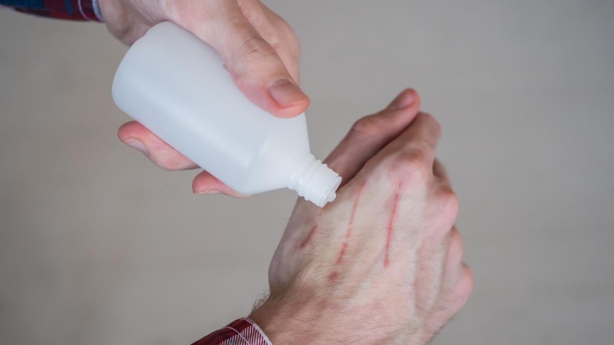 Jeśli rana nie chce się goić, trzeba to skonsultować z lekarzem