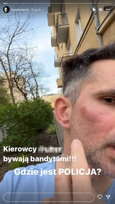 Marcin Bosak został pobity