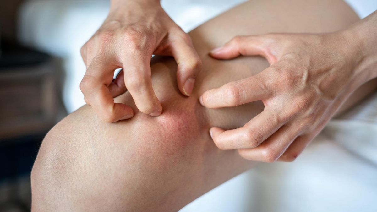 Objawy dysfunkcji jelit mogą być widoczne na skórze