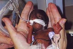 Rekordowy wcześniak przeżył i jest już w domu