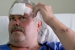 Ranny w wypadku: przeżyłem, bo miałem siłę