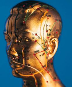 Akupunktura pomaga na bóle głowy