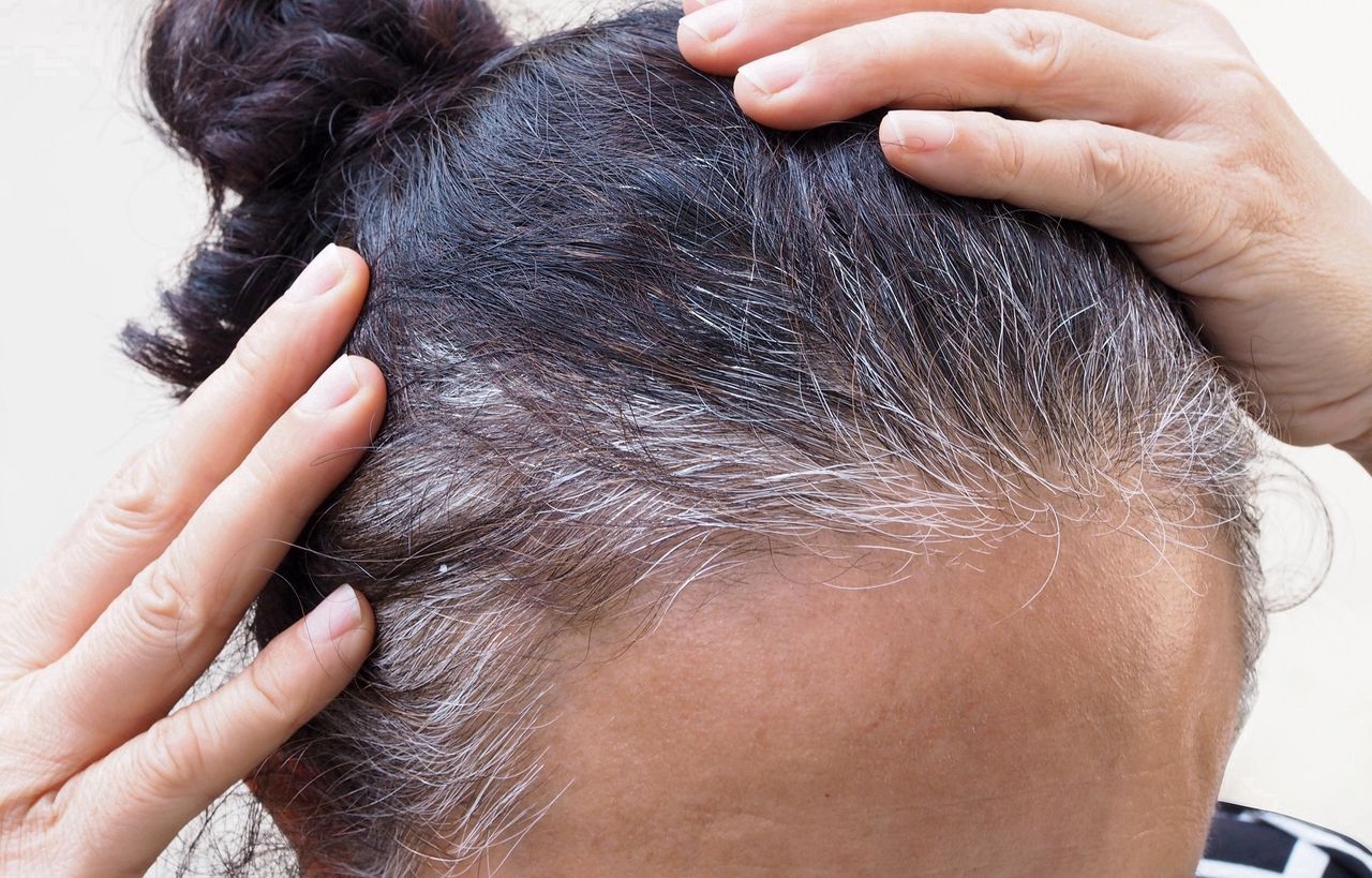 Natural ways to get rid of grey hair