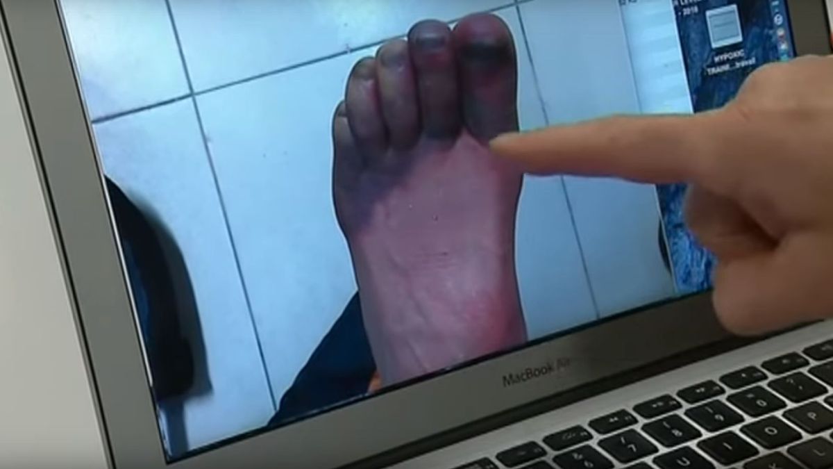 YouTube / Na zdjęciu odmrożone palce Elisabeth Revol