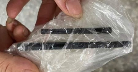 Bolała go głowa, tracił wzrok. Lekarz oniemiał, gdy zajrzał do nosa pacjenta