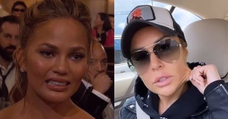 Chrissy Teigen WYCIĘŁA TŁUSZCZ Z POLICZKÓW! Obwiśnie jej skóra jak Blance Lipińskiej? (ZDJĘCIA)