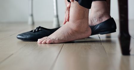 Sposób babć na spuchnięte stopy. Ulga jest natychmiastowa