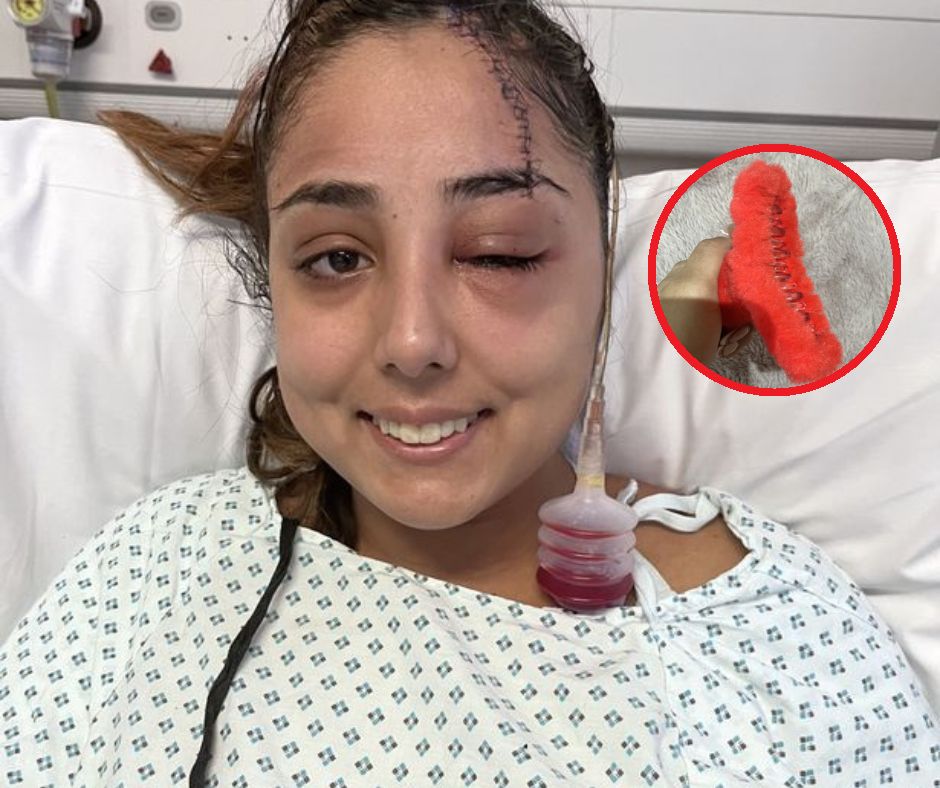 Ofiara wypadku ostrzega przed noszeniem klamerek