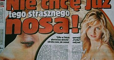 Frytka dostanie nowy nos