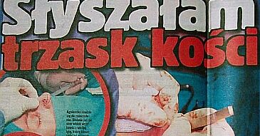 Frytka: "Chcę być piękna!"