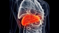 Głowa Meduzy. Objaw marskości wątroby i nadciśnienia wrotnego (WIDEO)