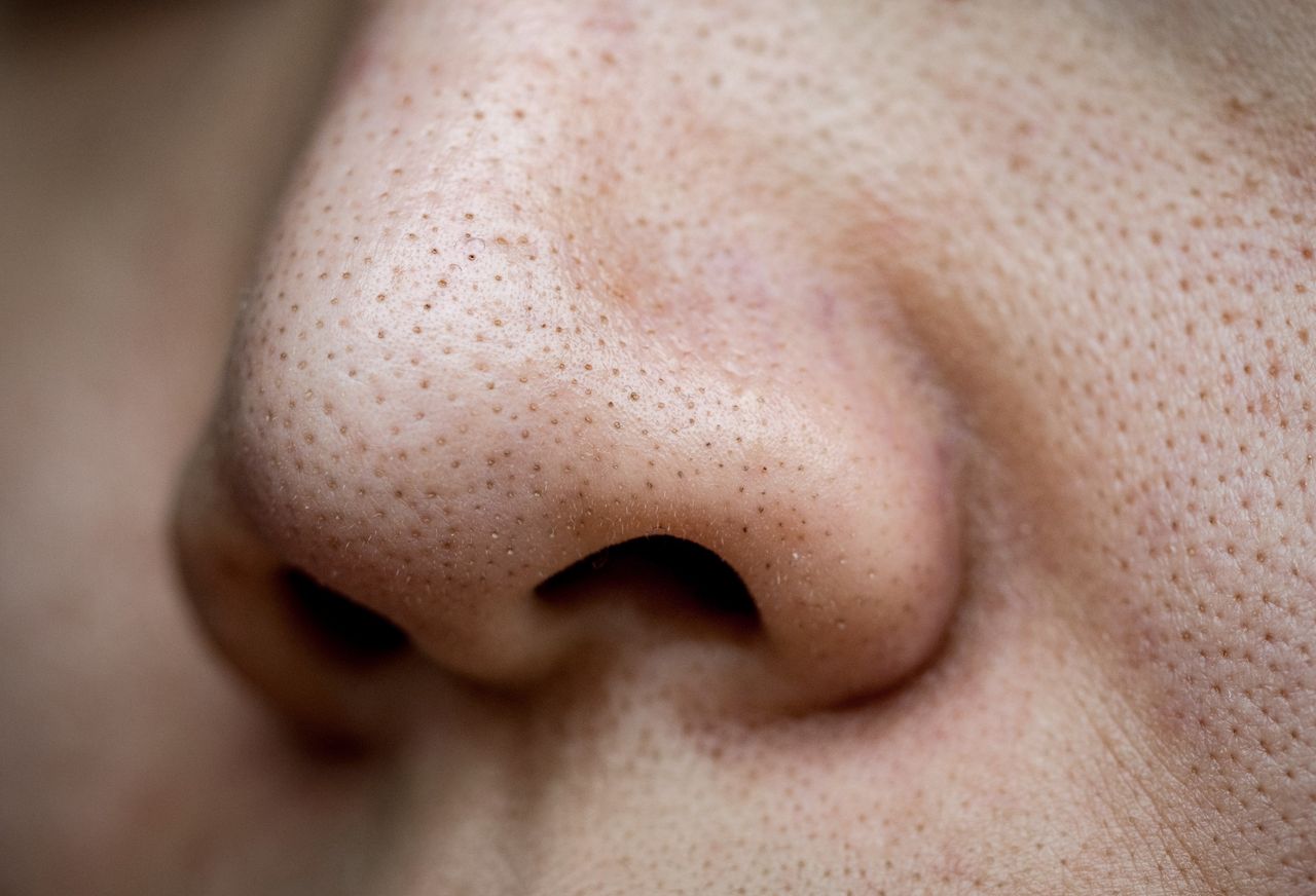 Domowe maseczki pomagają usunąć zaskórniki