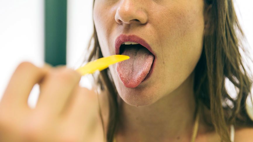 Jakie choroby można wyczytać z języka?