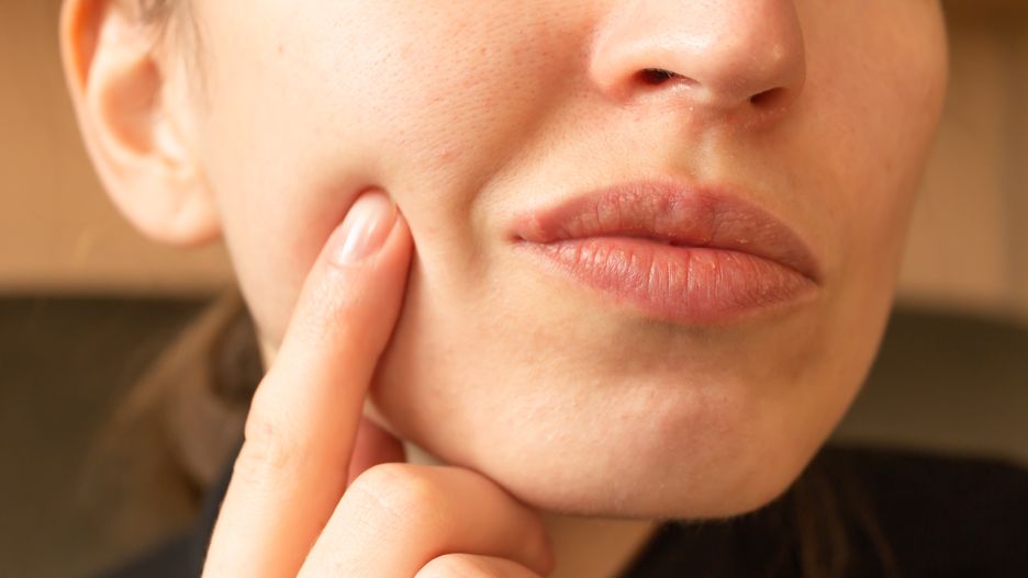 Young woman points her finger at her lips infected herpes virus. Indignation look. Diseases of the immune system.
Young woman points her finger at her lips infected herpes virus. Indignation look. Diseases of the immune system in winter and spring. Skin and health care. Horizontal photo. Close-up.
herpes, virus, lip, woman, face, touching, genetic, dermatology, cold, skincare, ugly, finger, unhealthy, pain, disease, spring, infection, mouth, illness, skin, sore, blister, person, problem, suffering, inflammation, medicine, hand, fever, complaint, sensitive, disgusting, health care, immunity, hurt, symptom, contagion, show, wellness, wellbeing, flu, cold sore, human lips, natural, pimple, looking, dissatisfied, virulent, young, closeup, herpes, virus, lip, woman, face, touching, genetic, dermatology, cold, skincare, ugly, finger, unhealthy, pain, disease, spring, infection, mouth, illness, skin, sore, blister, person, problem, suffering, inflammation, medicine, hand, fever, complaint, sensitive, disgusting, health care, immunity, hurt, symptom, contagion, show, wellness, wellbeing, flu, cold sore, human lips, natural, pimple, looking, dissatisfied, virulent, young