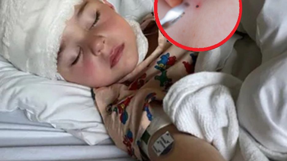 3-latek bawił się w basenie. Nagle jego mama zobaczyła czarną kropkę