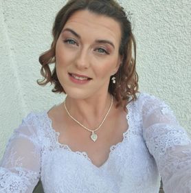 34-latkę uczuliła suknia ślubna. Jej ciało pokryły swędzące krosty