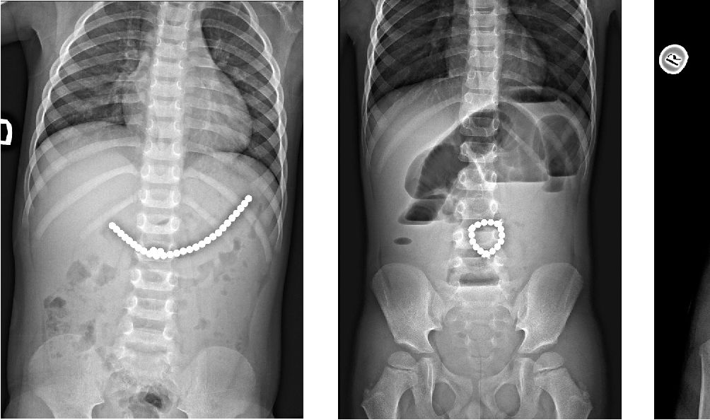 Magnesy widoczne na prześwietleniu