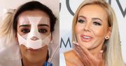 Monika Chwajoł pokazała, jak wyglądała przed korektą nosa! "Na początku jest taki JAK U ŚWINKI" (FOTO)