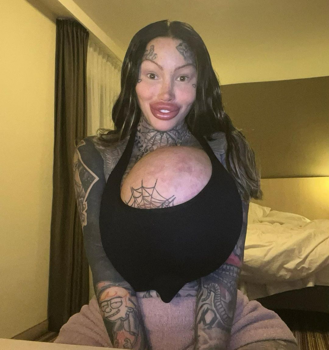 Instagramowej modelce wybuchł implant piersi. Ważył 10 kg