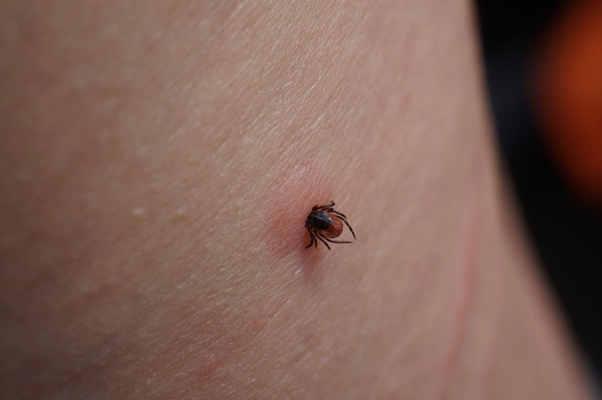 The season of highest tick activity occurs in the summer.