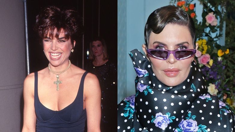 Te gwiazdy pożałowały operacji plastycznych