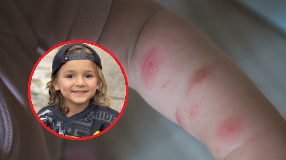 Szybko okazało się, że Ollie nie miał jednak ukąszeń, tylko rozwijała się u niego poważna choroba