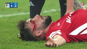 Sceny na dole Bundesligi! Pod koniec polała się krew