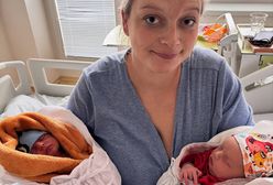 Niezwykła historia bliźniaków. Urodziły się w inny sposób i dzień