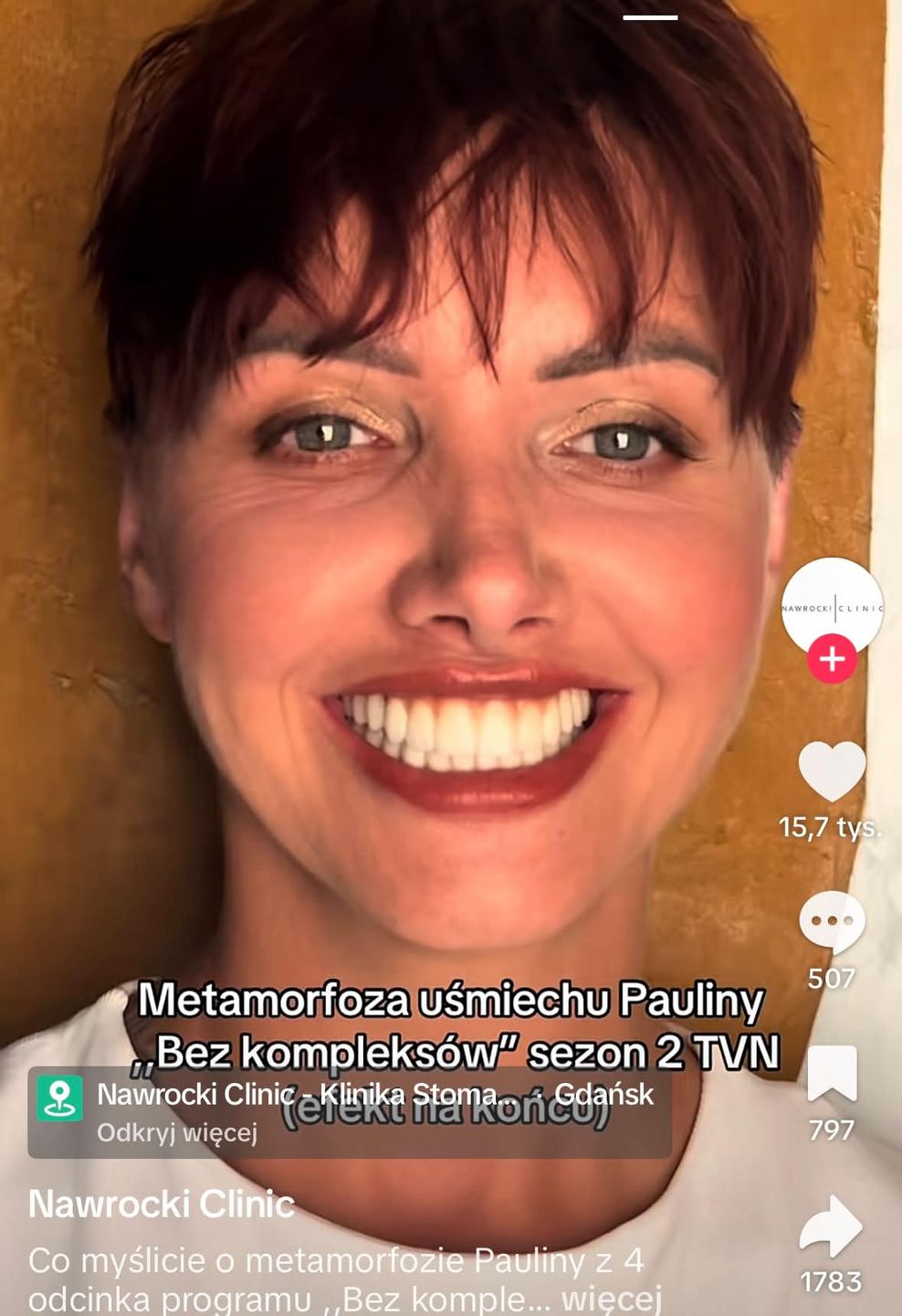 Metamorfoza zębów uczestniczki w programie "Bez kompleksów"