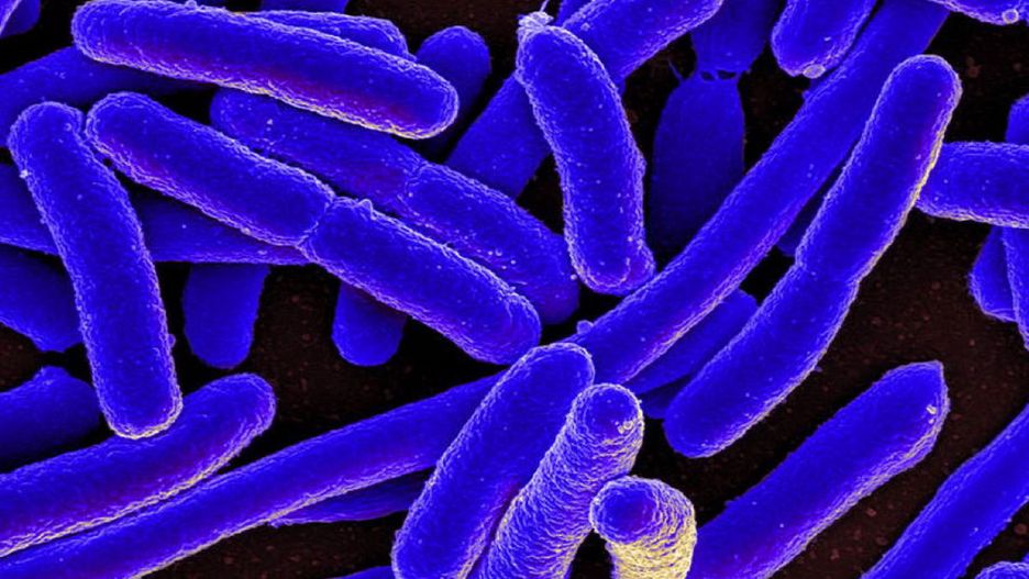 Bakterie E.Coli