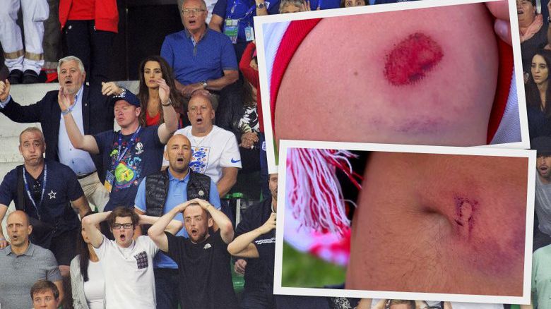 Polscy kibice zostali zaatakowanie przez francuską policję