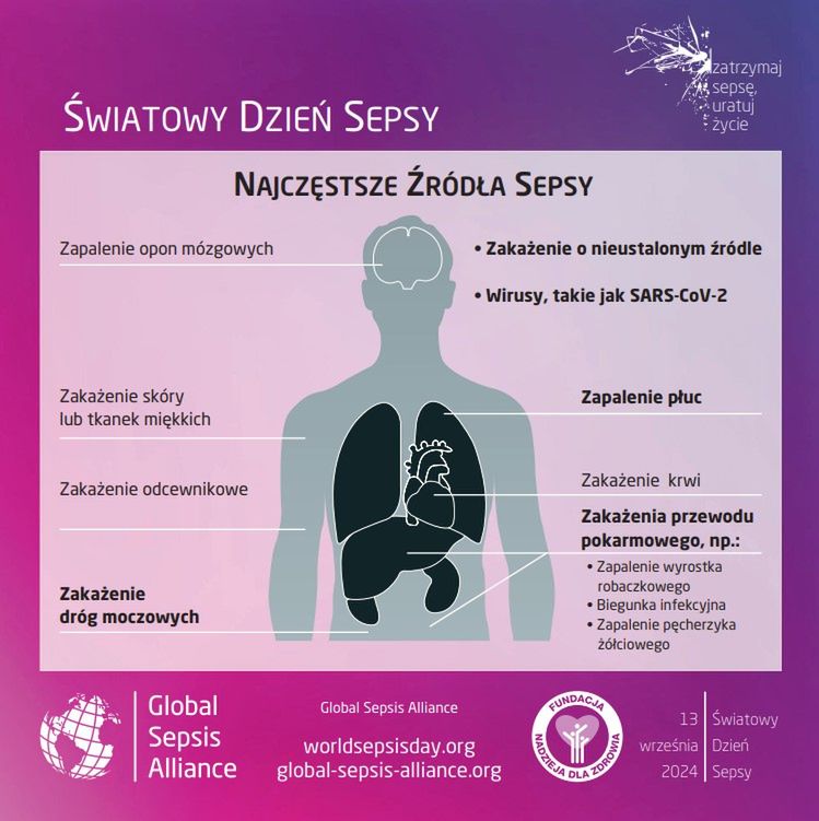 Najczęstsze źródła sepsy