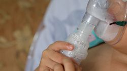 Wirus RSV wśród dzieci - objawy, leczenie. Dr Feleszko: Część dzieci, która jest zarażona tym wirusem, musi trafić do szpitala i otrzymać tlen (WIDEO)