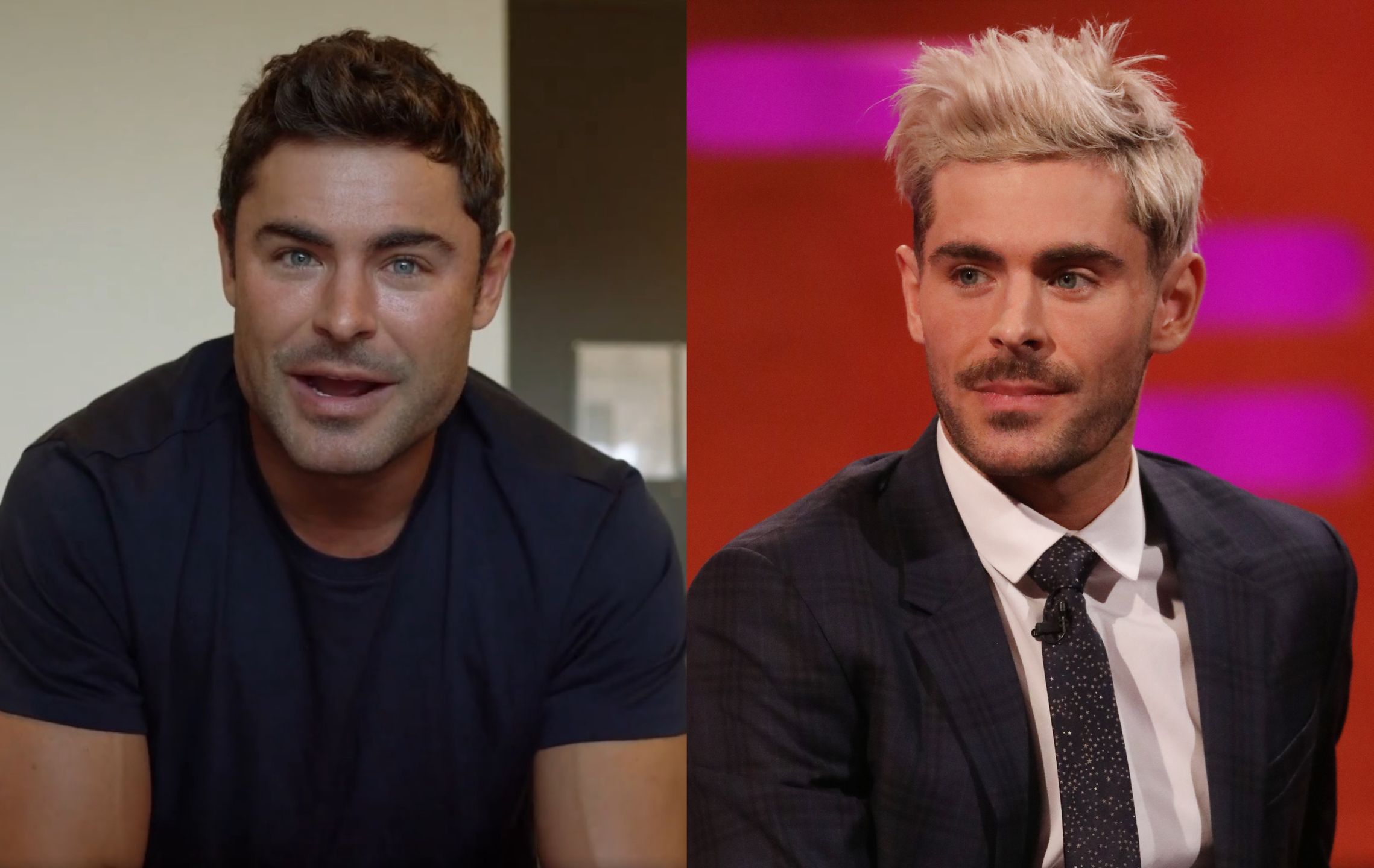 Zac Efron przeszedł operację plastyczną? Tak twierdzą fani
