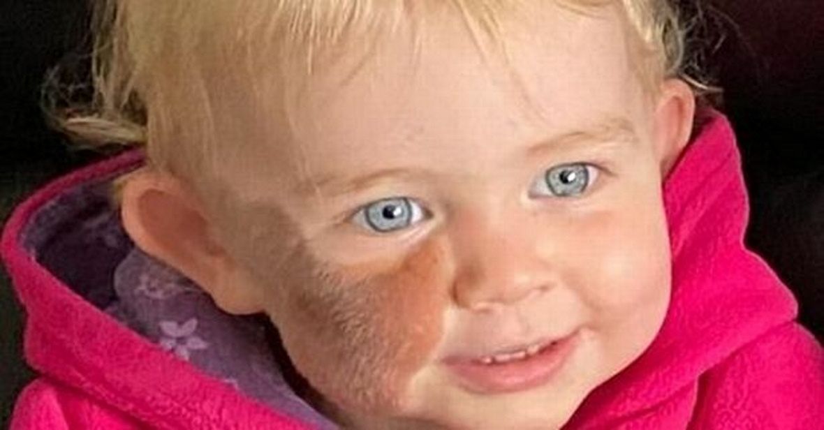 Dziewczynka urodziła się z 