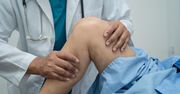 Ten ból nóg to nie chore stawy. To żyły zapchane cholesterolem
