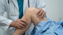 Ten ból nóg to nie chore stawy. To żyły zapchane cholesterolem