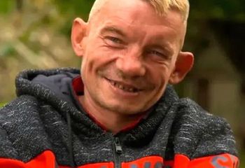 Bandziorek poszedł do dentysty. Tak zachowywał się w gabinecie