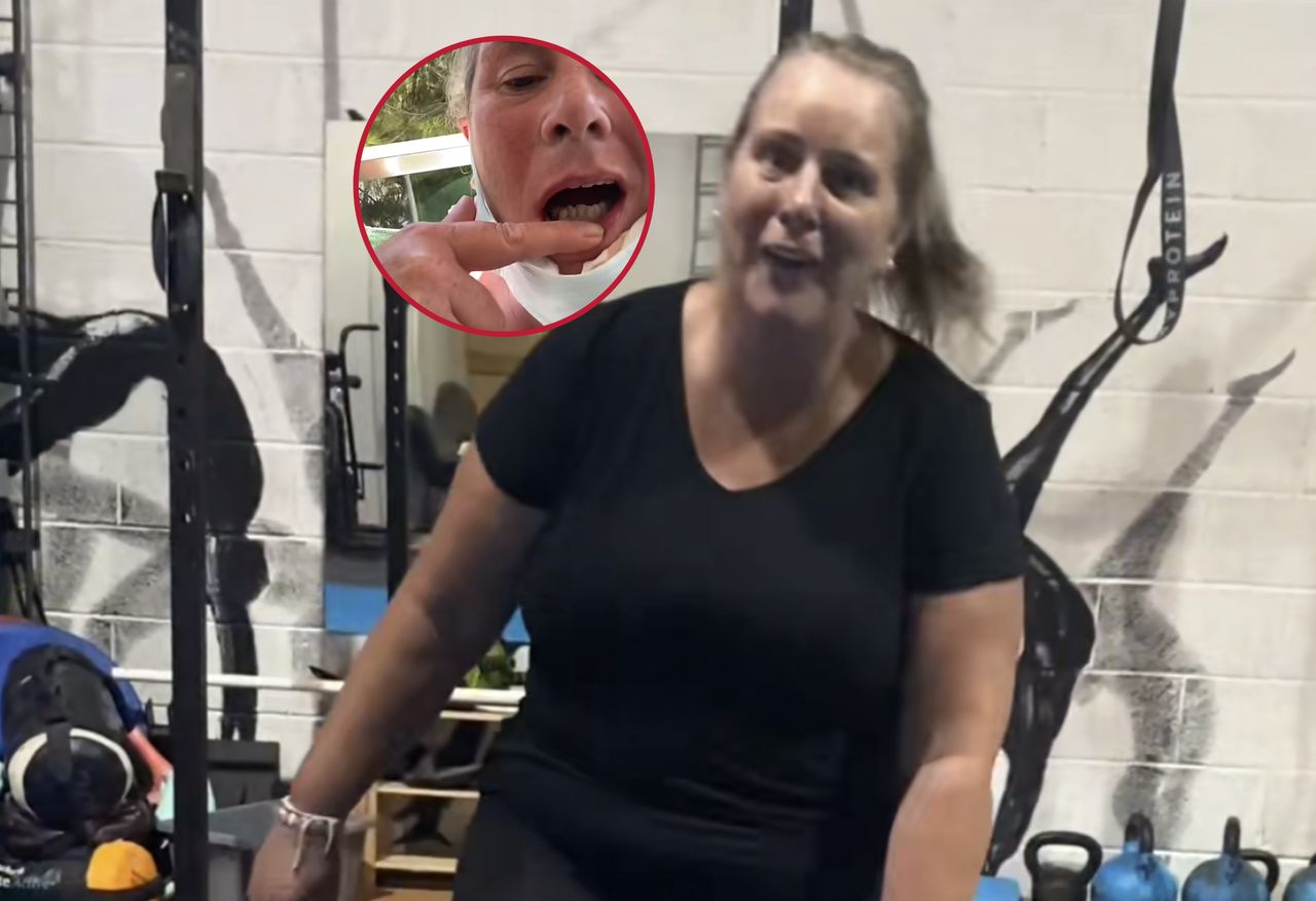 The TikToker explained why she regrets getting "Turkish" teeth.