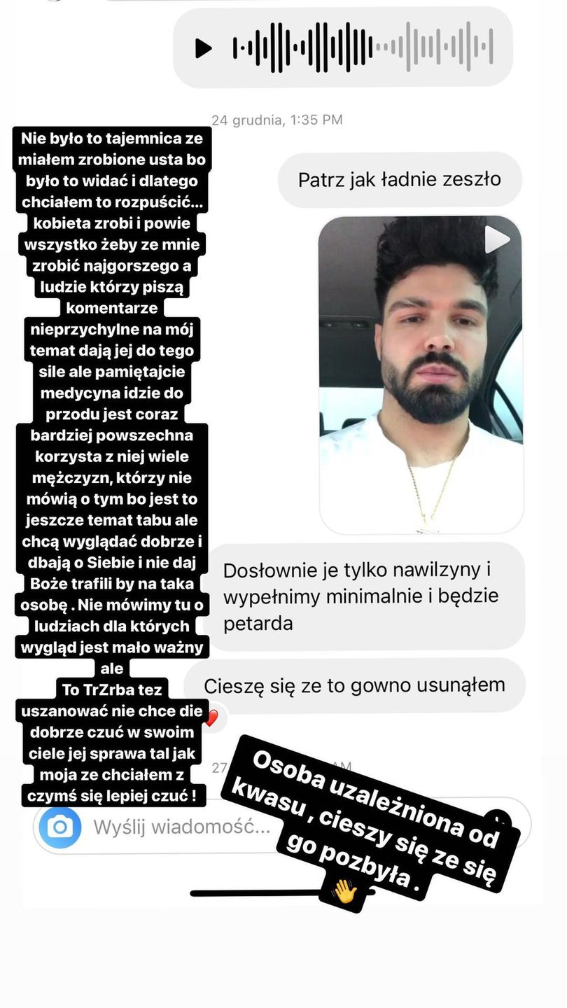 Paweł z "Love Island" odpowiada kosmetolog