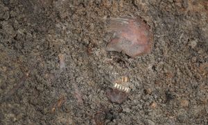 Czerwone kości żołnierzy z I wojny. Naukowcy poznali powód