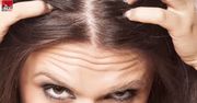 Dlaczego wypadają nam włosy? (WIDEO)