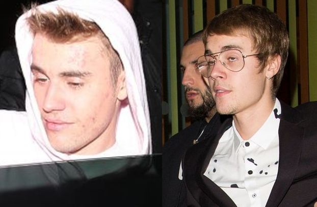 Justin Bieber rozlicza się z przeszłością: "Zacząłem brać CIĘŻKIE narkotyki w wieku 19 lat! Nie szanowałem kobiet"