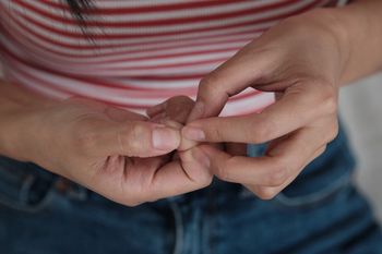 Charakterystyczne plamki na paznokciach. Lepiej ich nie lekceważ