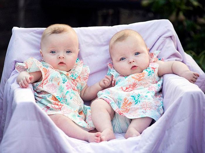 (dailymail.co.uk) Chociaż Dakota i Scarlett nie miały dużych szans na przeżycie, teraz rosną i zdrowo się rozwijają