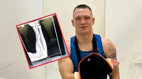 Tylko zobacz, co się stało z ręką polskiego mistrza. Od razu trafił do szpitala