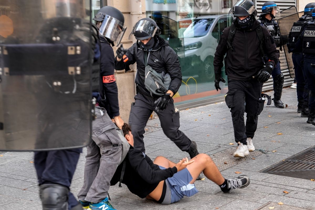 Koszmar we Francji. 15-latek stracił dłoń
