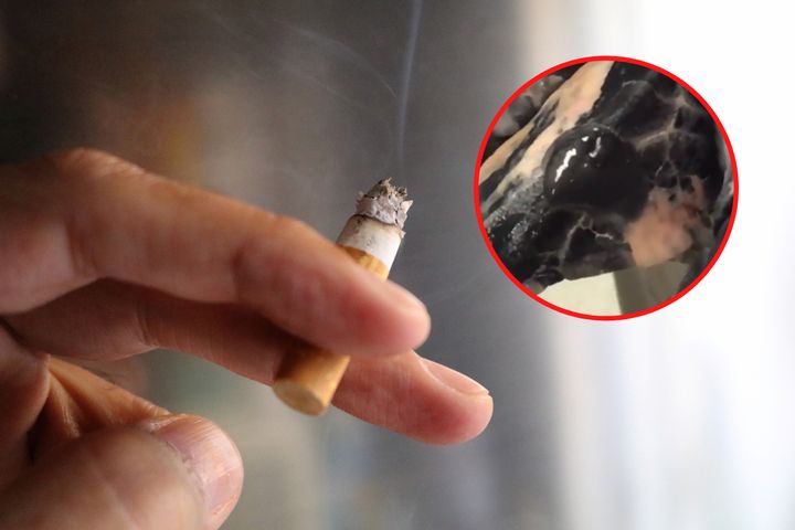 Płuca czarne niczym smoła to skutek palenia papierosów